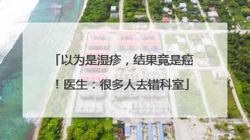 以为是湿疹，结果竟是癌！医生：很多人去错科室