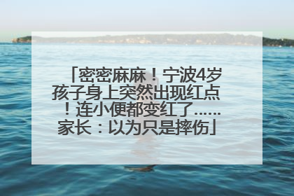 密密麻麻！宁波4岁孩子身上突然出现红点！连小便都变红了……家长：以为只是摔伤